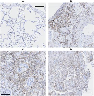 Fibroblast activation protein is a cellular marker of fibrotic activity in canine idiopathic pulmonary fibrosis